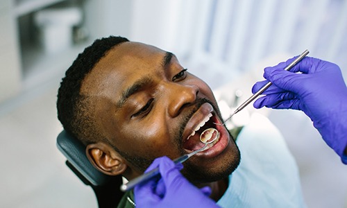Closeup of male patient during dental checkup