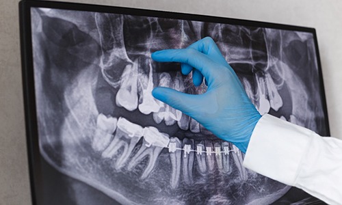 dentist looking at dental X-ray