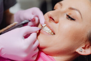 Dentist placing Lumineer on woman’s teeth